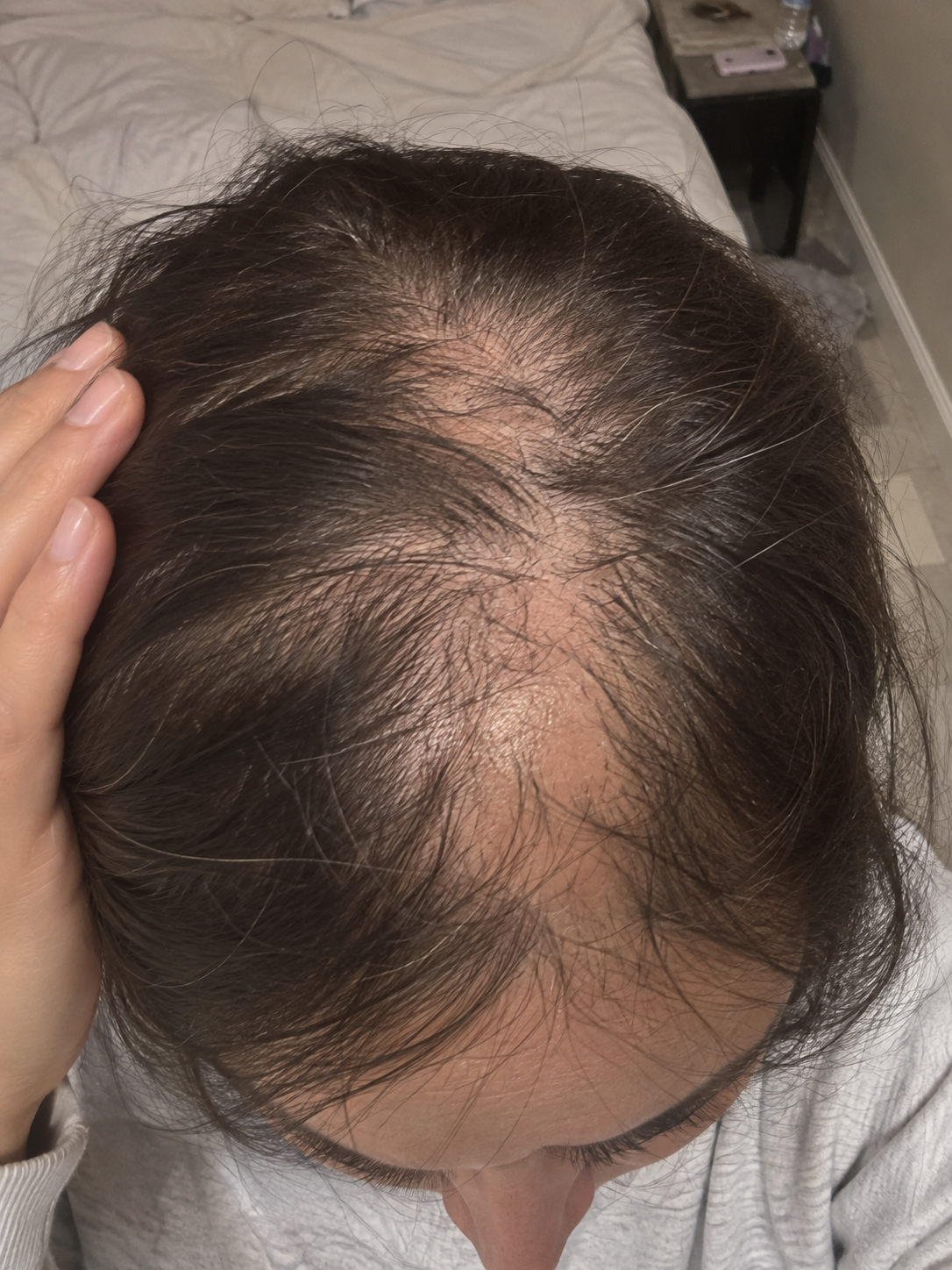 Before: sparse, thinning at the crown